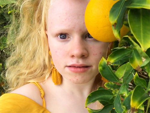 An upclose image of Karin, wearing yellow earrings and top, next to a lemon tree.