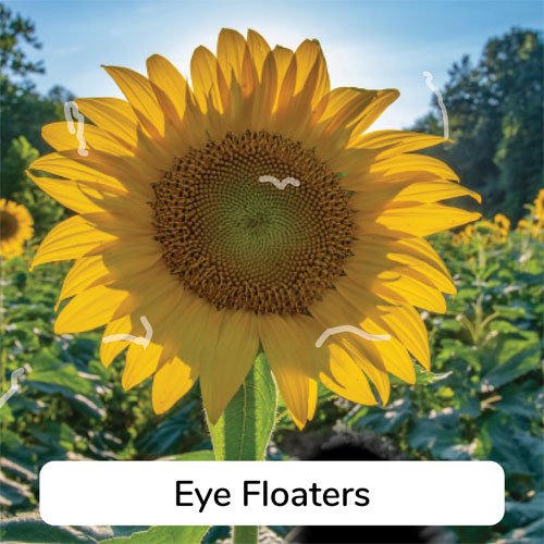 Simulation of what eye floaters look like